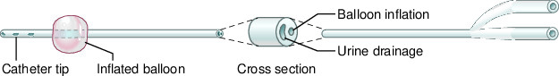 Descriptive text is not available for this image