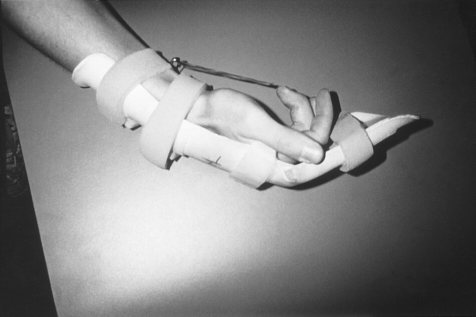 splint Taber's Medical Dictionary